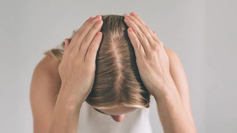 Kadınlarda Saç Dökülmesi Nedenleri ?
