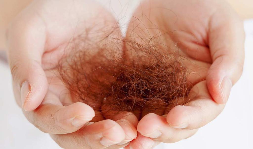 Saç Dökülmesinin Başlıca Sebepleri Nelerdir?